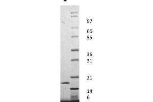 SDS-PAGE of Human Interleukin-1-alpha Recombinant Protein SDS-PAGE Human Interleukin-1-alpha Recombinant Protein.
