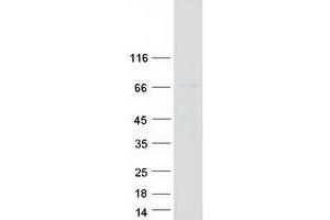 Validation with Western Blot