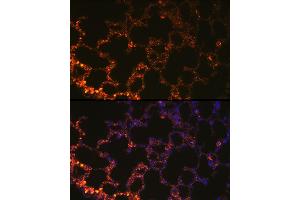 Immunofluorescence analysis of mouse lung cells using NAPSA Rabbit pAb (ABIN6128367, ABIN6144368, ABIN6144369 and ABIN6221232) at dilution of 1:100 (40x lens).