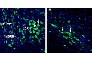 Expression of Lynx1 in rat dorsal raphe nucleus and substantia nigra pars compacta - Immunohistochemical staining of perfusion-fixed frozen rat brain sections with Anti-Lynx1 (extracellular) Antibody (ABIN7043310, ABIN7044635 and ABIN7044636), (1:1000), followed by goat anti-rabbit-AlexaFluor-488. (LYNX1 anticorps  (Extracellular, N-Term))