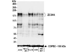 Western Blotting (WB) image for anti-Zinc Finger CCCH-Type Containing 4 (ZC3H4) (AA 1050-1100) antibody (ABIN7795760)