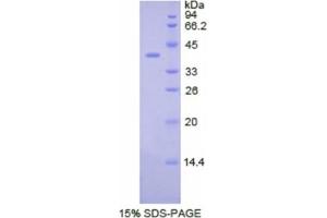 SDS-PAGE analysis of Human CSF2Rb Protein. (CD131 Protéine)