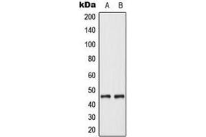 Western blot analysis of Cytokeratin 18 expression in MCF7 (A), Jurkat (B) whole cell lysates. (Cytokeratin 18 anticorps  (N-Term))