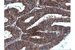 Image no. 1 for anti-Phosphatidylinositol-4-Phosphate 3-Kinase, Catalytic Subunit Type 2 beta (PIK3C2B) antibody (ABIN1500199)