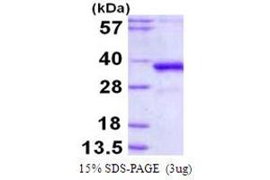 SDS-PAGE (SDS) image for Polymerase (DNA Directed), lambda (POLL) (AA 1-300) protein (His tag) (ABIN7279597)