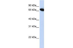 WB Suggested Anti-DLX4 Antibody Titration:  0. (DLX4 anticorps  (Middle Region))