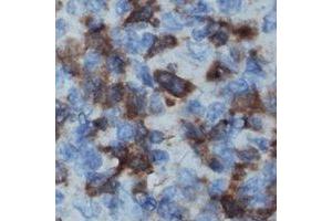 Immunohistochemical analysis of IL-16 staining in human lymph node formalin fixed paraffin embedded tissue section. (IL16 anticorps  (N-Term))
