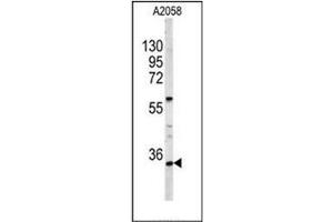 Western blot analysis of HOXA9 / HOX1G Antibody (C-term) in A2058 cell line lysates (35ug/lane).