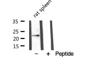 Western blot analysis of extracts from rat spleen , using TNFC antibody. (LTB anticorps  (C-Term))