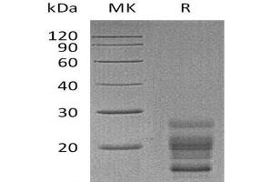 Western Blotting (WB) image for Interleukin 17A (IL17A) (Active) protein (His tag) (ABIN7320557)