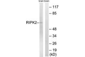 Western blot analysis of extracts from rat brain cells, using RIPK2 (Ab-176) Antibody. (RIPK2 anticorps  (AA 146-195))