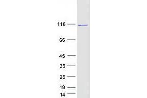 Validation with Western Blot