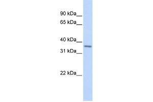WB Suggested Anti-TLX1 Antibody Titration:  0.