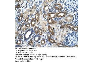 Immunohistochemistry (IHC) image for anti-Pyruvate Kinase, Liver and RBC (PKLR) (N-Term) antibody (ABIN310205) (PKLR anticorps  (N-Term))