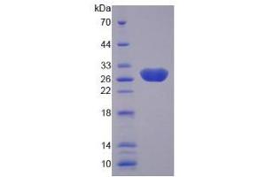 SDS-PAGE analysis of Human Laminin alpha 4 Protein. (LAMa4 Protéine)