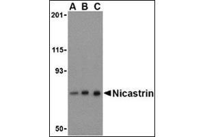 Western blot analysis of Nicastrin in mouse brain tissue lysate with this product at (A) 0. (Nicastrin anticorps  (C-Term))