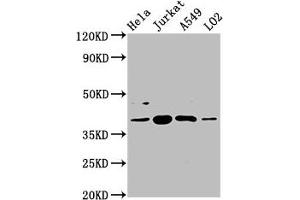 Western Blot Positive WB detected in: Hela whole cell lysate, Jurkat whole cell lysate, A549 whole cell lysate, LO2 whole cell lysate All lanes: SHARPIN antibody at 5. (SHARPIN anticorps  (AA 82-171))
