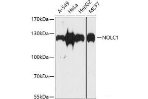 Western blot analysis of extracts of various cell lines using NOLC1 Polyclonal Antibody at dilution of 1:1000. (NOLC1 anticorps)