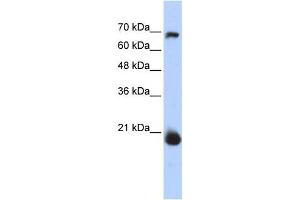 Western Blotting (WB) image for anti-Coiled-Coil-Helix-Coiled-Coil-Helix Domain Containing 4 (CHCHD4) antibody (ABIN2459506)