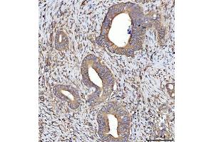 IHC analysis of SEPT7/SEPTIN7 using anti-SEPT7/SEPTIN7 antibody (ABIN7599301). (Septin 7 anticorps  (AA 1-351))