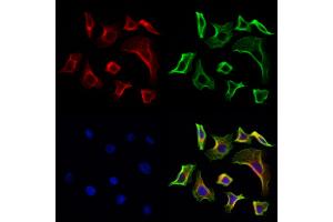 ABIN6261678 and ABIN6268891 staining Hela cells by IF/ICC at 1:100(red).