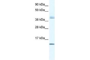 Human Liver; WB Suggested Anti-TSFM Antibody Titration: 0. (TSFM anticorps  (N-Term))