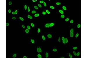 Immunofluorescence staining of Hela cells with ABIN7139612 at 1:15, counter-stained with DAPI.
