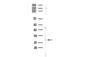 Western blot analysis of lysates from HepG2 cells(starvation,24h treatment), using RAP2C Antibody at 1/1000 dilution.