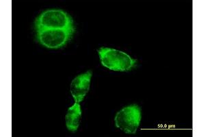Immunofluorescence of purified MaxPab antibody to SRGAP1 on HeLa cell.