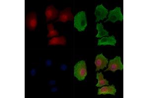 Phospho-SGK1 (Ser78) Antibody staining HepG2 cells(serum starvation treatment) by IF/ICC. (SGK1 anticorps  (pSer78))