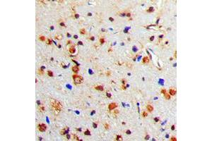 Immunohistochemical analysis of Tyrosine Hydroxylase (pS71) staining in human brain formalin fixed paraffin embedded tissue section.