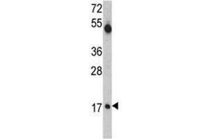 Western blot analysis of UBE2V1 antibody and mouse cerebellum tissue lysate.