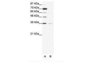 Image no. 1 for anti-Zinc Finger Protein 326 (ZNF326) (AA 469-518) antibody (ABIN203092) (ZNF326 anticorps  (AA 469-518))