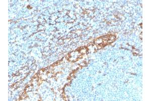 Formalin-fixed, paraffin-embedded human tonsil stained with Podoplanin Recombinant Rabbit Monoclonal Antibody (PDPN/4009R). (Recombinant Podoplanin anticorps  (AA 1-100))
