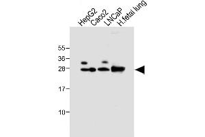 All lanes : Anti-GSTA1 Antibody at 1:4000 dilution Lane 1: HepG2 whole cell lysate Lane 2: Caco2 whole cell lysate Lane 3: LNCaP whole cell lysate Lane 4: Human fetal lung tissue lysate Lysates/proteins at 20 μg per lane. (GSTA1 anticorps)