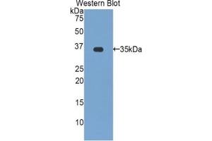 Detection of Recombinant zAP70, Human using Polyclonal Antibody to Zeta Chain Associated Protein Kinase 70 kDa (zAP70) (ZAP70 anticorps  (AA 337-600))