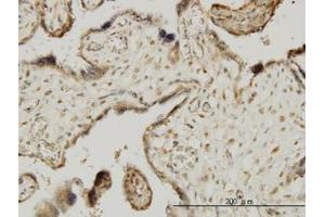 Image no. 1 for anti-Mitogen-Activated Protein Kinase-Activated Protein Kinase 3 (MAPKAPK3) (AA 272-382) antibody (ABIN599019) (MAPKAP Kinase 3 anticorps  (AA 272-382))