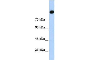 WB Suggested Anti-C2 Antibody Titration:  1. (Complement C2 anticorps  (Middle Region))