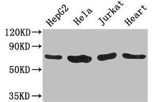 Western Blot Positive WB detected in: HepG2 whole cell lysate, Hela whole cell lysate, Jurkat whole cell lysate, Mouse heart tissue All lanes: CHFR antibody at 3. (CHFR anticorps  (AA 141-422))