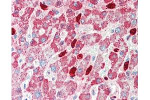 Human, Liver: Formalin-Fixed Paraffin-Embedded (FFPE).