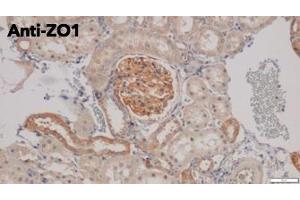 Immunohistochemistry (IHC) image for anti-Tight Junction Protein 1 (TJP1) (C-Term) antibody (ABIN6254231)