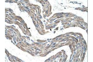 Image no. 1 for anti-G Protein-Coupled Receptor 161 (GPR161) (C-Term) antibody (ABIN203448)