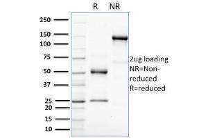 SDS-PAGE Analysis Purified HER-4 / ERBB4 Mouse Monoclonal Antibody (HFR-1).