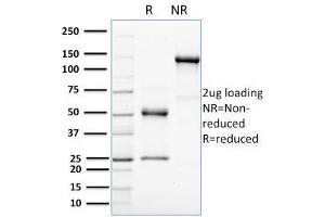 SDS-PAGE Analysis Purified HER-4 / ERBB4 Mouse Monoclonal Antibody (HFR-1). (ERBB4 anticorps  (AA 1116-1269))