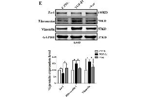 Inhibiting the co-transcription complex YAP/TEAD reverses A549 cell proliferation, migration, and invasion induced by TGF-β1. (GAPDH anticorps)