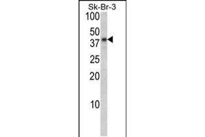 Western blot analysis of BGN Antibody in Sk-Br-3 cell line lysates (35ug/lane) (Biglycan anticorps  (AA 148-176))