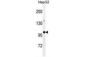 GPAM Antibody (Center) western blot analysis in HepG2 cell line lysates (35µg/lane). (GPAM anticorps  (Middle Region))