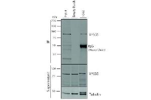Immunoprecipitation analysis using Mouse Anti-VPS35 Monoclonal Antibody, Clone 10A8 (ABIN6932982).