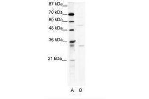 Image no. 1 for anti-TRIM17 / RNF16 (TRIM17) (AA 381-430) antibody (ABIN203174) (TRIM17 / RNF16 anticorps  (AA 381-430))