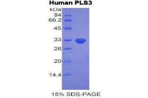 SDS-PAGE (SDS) image for Plastin 3 (PLS3) (AA 379-630) protein (His tag) (ABIN2121905) (Plastin 3 Protein (PLS3) (AA 379-630) (His tag))